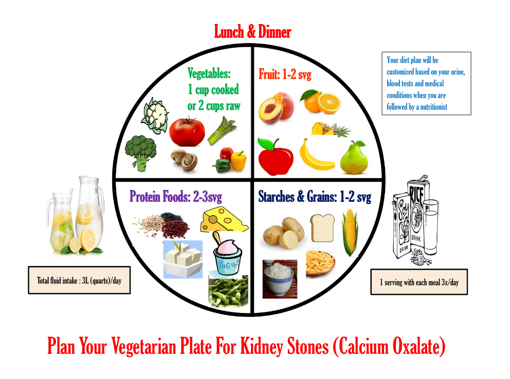 How To Avoid A Kidney Stone Plantforce21