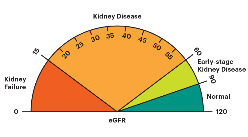 creatinine kidney disease chart
