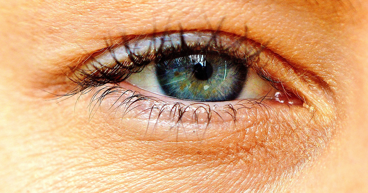 Yellow Eyes: Causes and Treatment