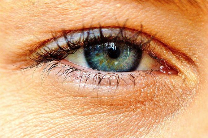 what do blind peoples eyes look like