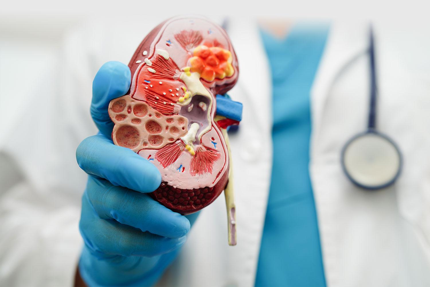 doctor showing 3D medical model of a kidney 